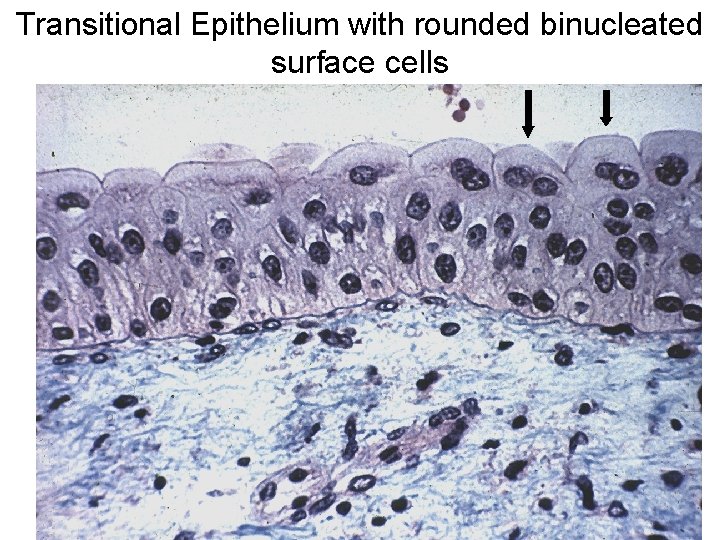 Transitional Epithelium with rounded binucleated surface cells 