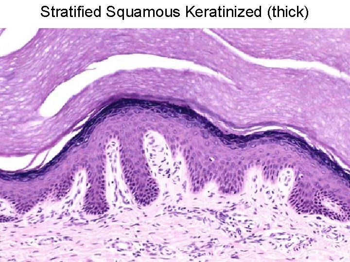 Stratified Squamous Keratinized (thick) 