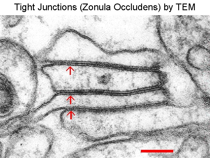 Tight Junctions (Zonula Occludens) by TEM 