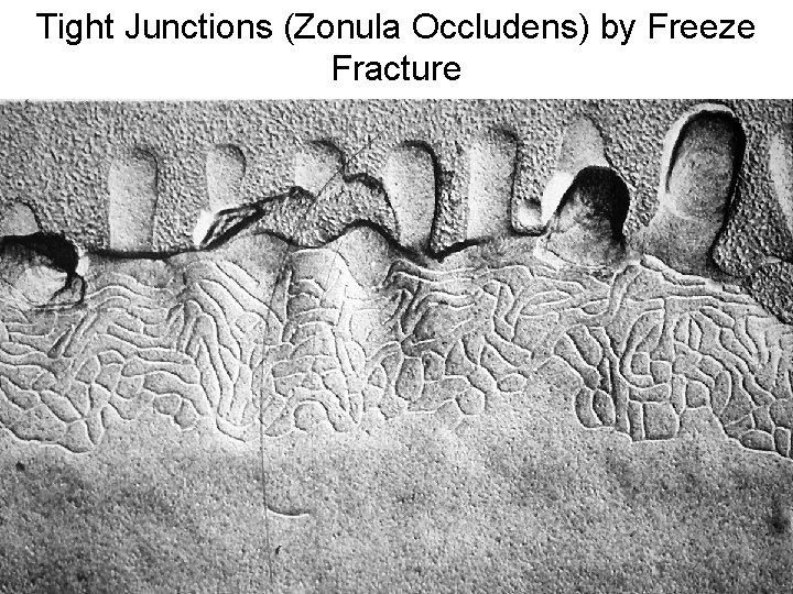 Tight Junctions (Zonula Occludens) by Freeze Fracture 