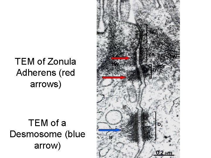 TEM of Zonula Adherens (red arrows) TEM of a Desmosome (blue arrow) 