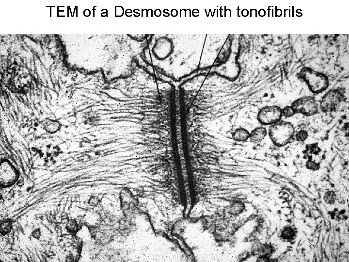 TEM of a Desmosome with tonofibrils 