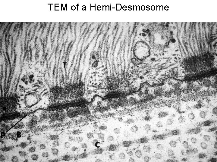 TEM of a Hemi-Desmosome 