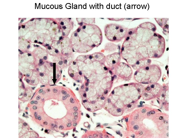 Mucous Gland with duct (arrow) 