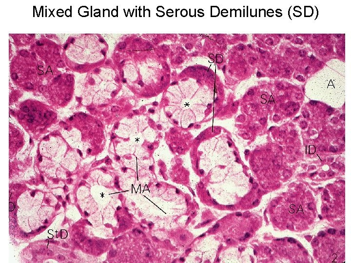 Mixed Gland with Serous Demilunes (SD) 