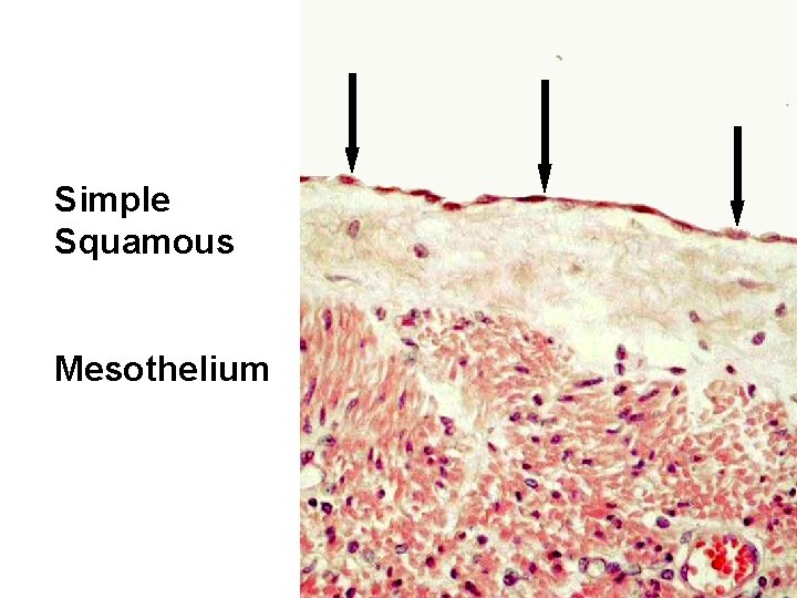 Simple Squamous Mesothelium 