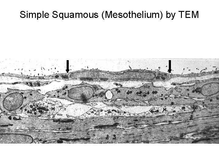 Simple Squamous (Mesothelium) by TEM 