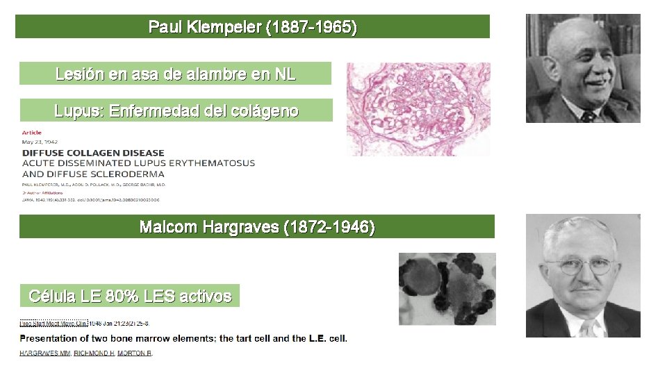 Paul Klempeler (1887 -1965) Lesión en asa de alambre en NL Lupus: Enfermedad del