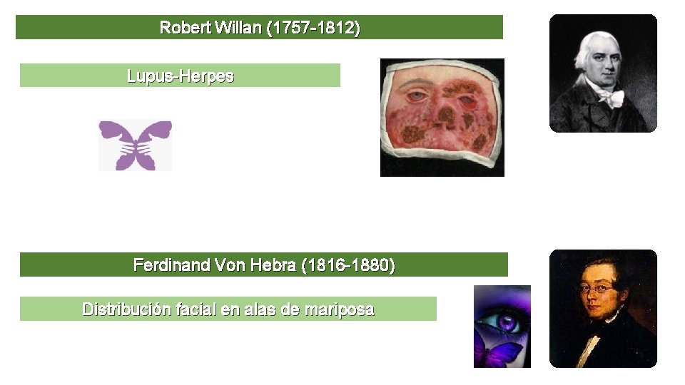 Robert Willan (1757 -1812) Lupus-Herpes Ferdinand Von Hebra (1816 -1880) Distribución facial en alas