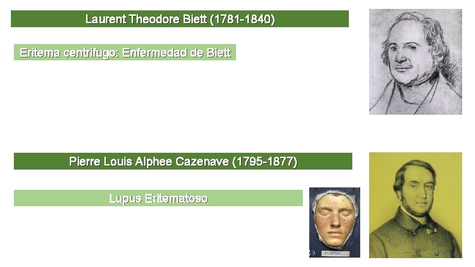 Laurent Theodore Biett (1781 -1840) Eritema centrifugo: Enfermedad de Biett Pierre Louis Alphee Cazenave