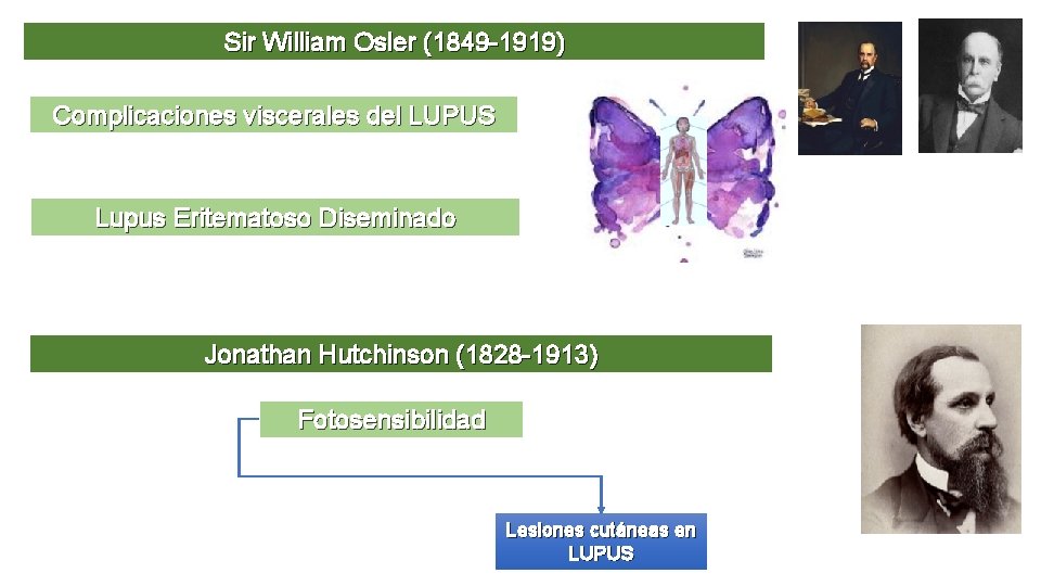 Sir William Osler (1849 -1919) Complicaciones viscerales del LUPUS Lupus Eritematoso Diseminado Jonathan Hutchinson