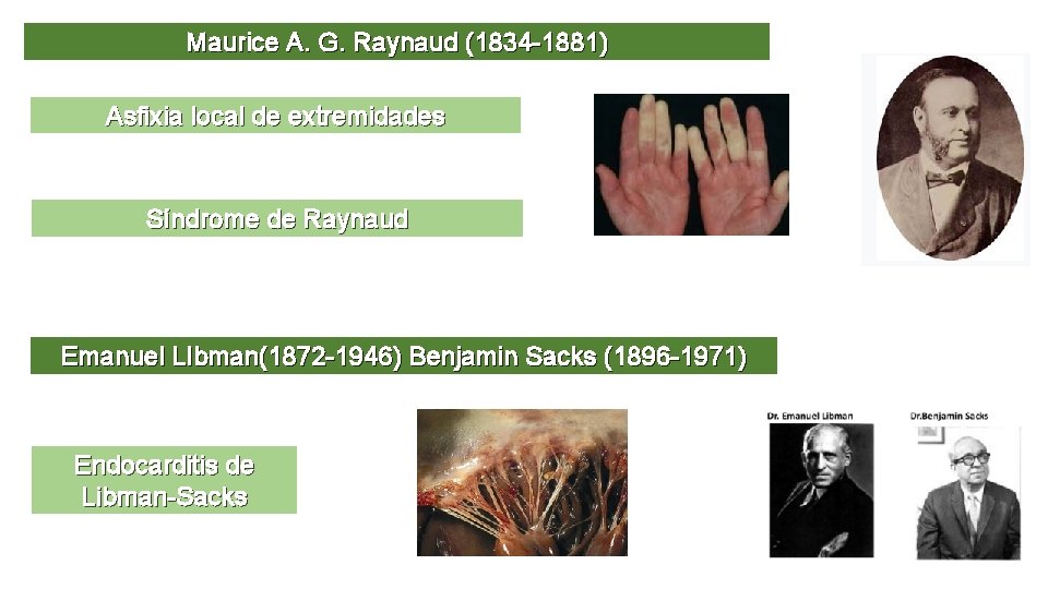 Maurice A. G. Raynaud (1834 -1881) Asfixia local de extremidades Síndrome de Raynaud Emanuel