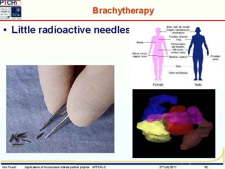 Brachytherapy • Little radioactive needles Ken Peach Applications of Accelerators outside particle physics APPEAL-2