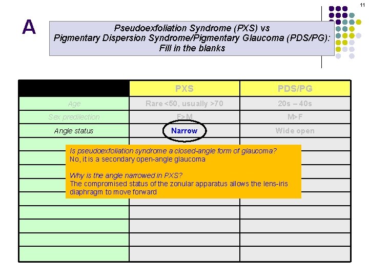 11 A Pseudoexfoliation Syndrome (PXS) vs Pigmentary Dispersion Syndrome/Pigmentary Glaucoma (PDS/PG): Fill in the