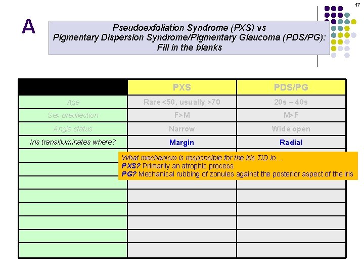 17 A Pseudoexfoliation Syndrome (PXS) vs Pigmentary Dispersion Syndrome/Pigmentary Glaucoma (PDS/PG): Fill in the