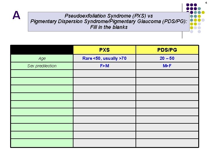 4 A Pseudoexfoliation Syndrome (PXS) vs Pigmentary Dispersion Syndrome/Pigmentary Glaucoma (PDS/PG): Fill in the