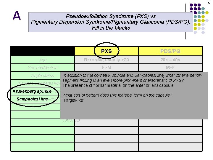 57 A Pseudoexfoliation Syndrome (PXS) vs Pigmentary Dispersion Syndrome/Pigmentary Glaucoma (PDS/PG): Fill in the