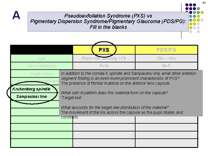 61 A Pseudoexfoliation Syndrome (PXS) vs Pigmentary Dispersion Syndrome/Pigmentary Glaucoma (PDS/PG): Fill in the