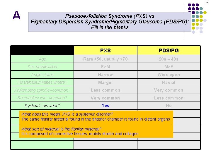 71 A Pseudoexfoliation Syndrome (PXS) vs Pigmentary Dispersion Syndrome/Pigmentary Glaucoma (PDS/PG): Fill in the
