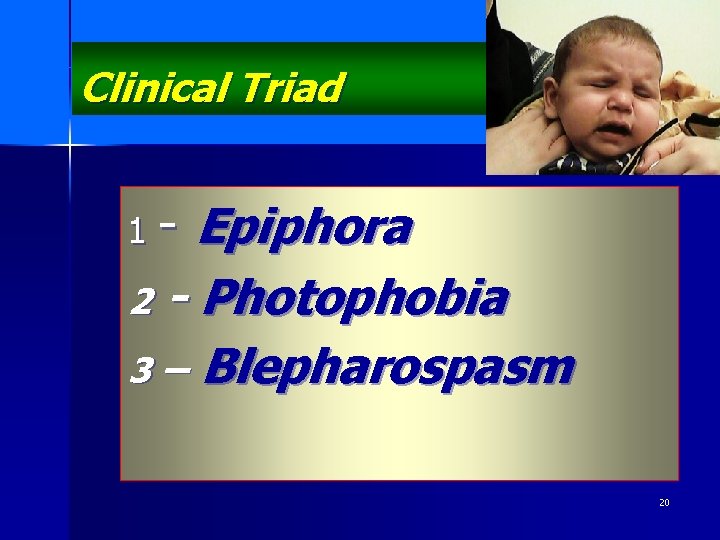 Clinical Triad 1 - Epiphora 2 - Photophobia 3 – Blepharospasm 20 