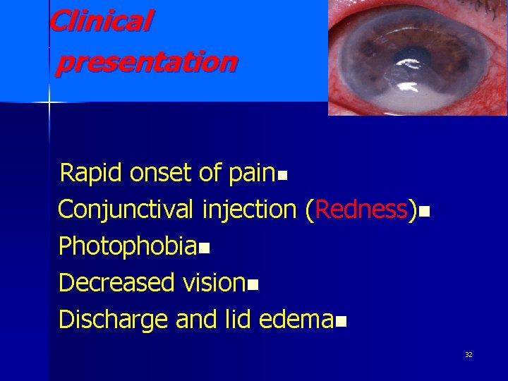 Clinical presentation Rapid onset of painn Conjunctival injection (Redness)n Photophobian Decreased visionn Discharge and