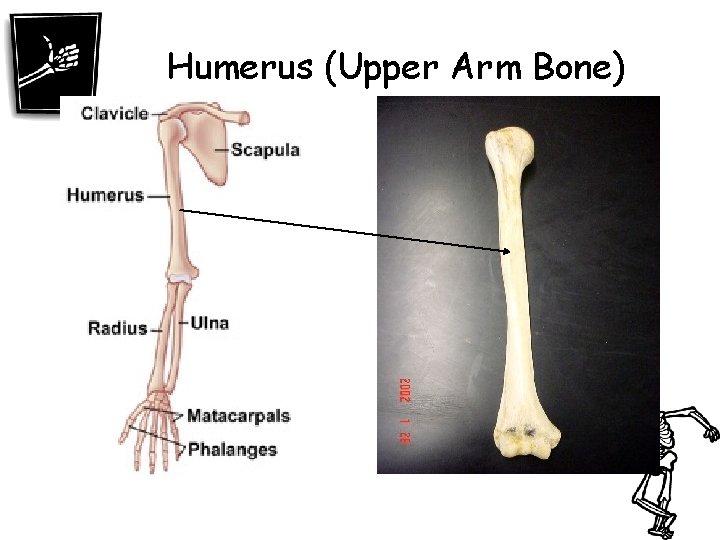 Humerus (Upper Arm Bone) 
