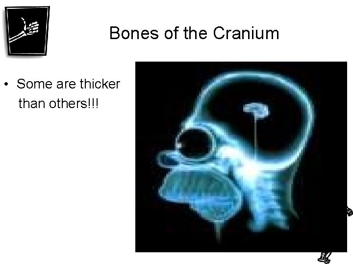 Bones of the Cranium • Some are thicker than others!!! 