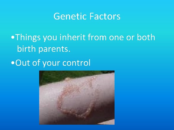 Genetic Factors • Things you inherit from one or both birth parents. • Out