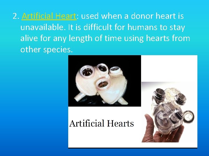 2. Artificial Heart: used when a donor heart is unavailable. It is difficult for