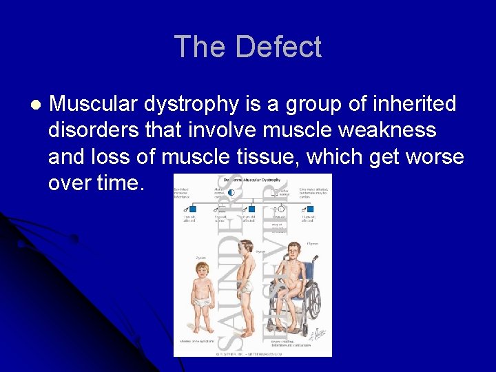 The Defect l Muscular dystrophy is a group of inherited disorders that involve muscle