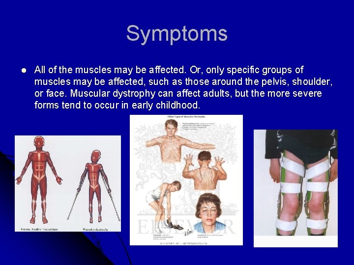 Symptoms l All of the muscles may be affected. Or, only specific groups of