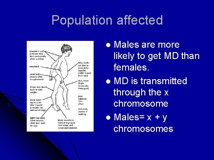 Population affected Males are more likely to get MD than females. l MD is