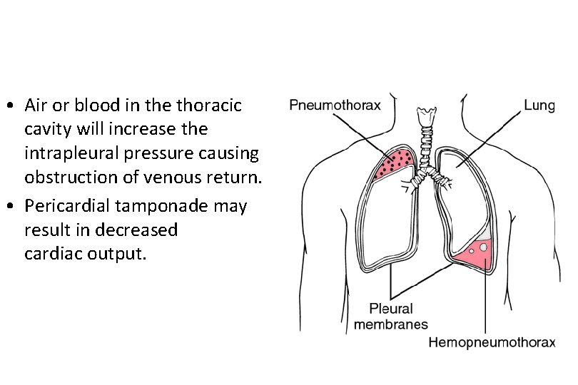  • Air or blood in the thoracic cavity will increase the intrapleural pressure