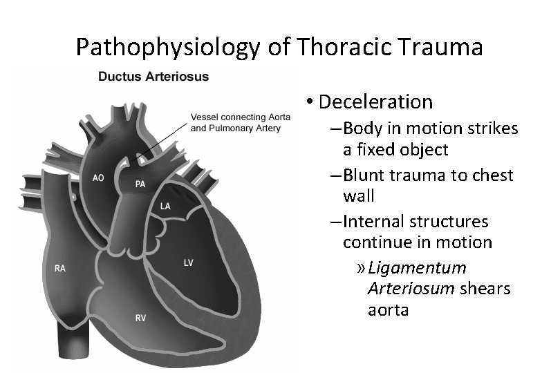 Pathophysiology of Thoracic Trauma • Deceleration – Body in motion strikes a fixed object