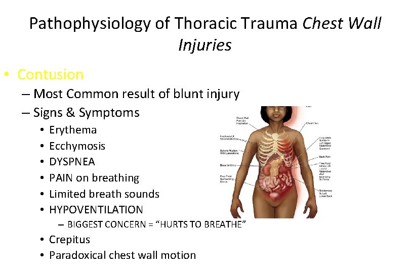 Pathophysiology of Thoracic Trauma Chest Wall Injuries • Contusion – Most Common result of