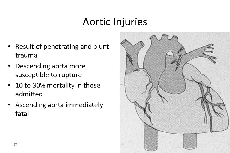 Aortic Injuries • Result of penetrating and blunt trauma • Descending aorta more susceptible