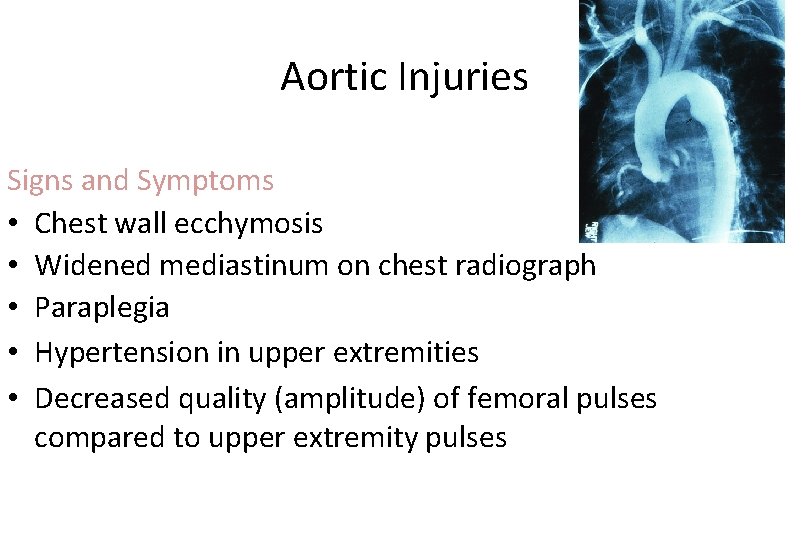 Aortic Injuries Signs and Symptoms • Chest wall ecchymosis • Widened mediastinum on chest