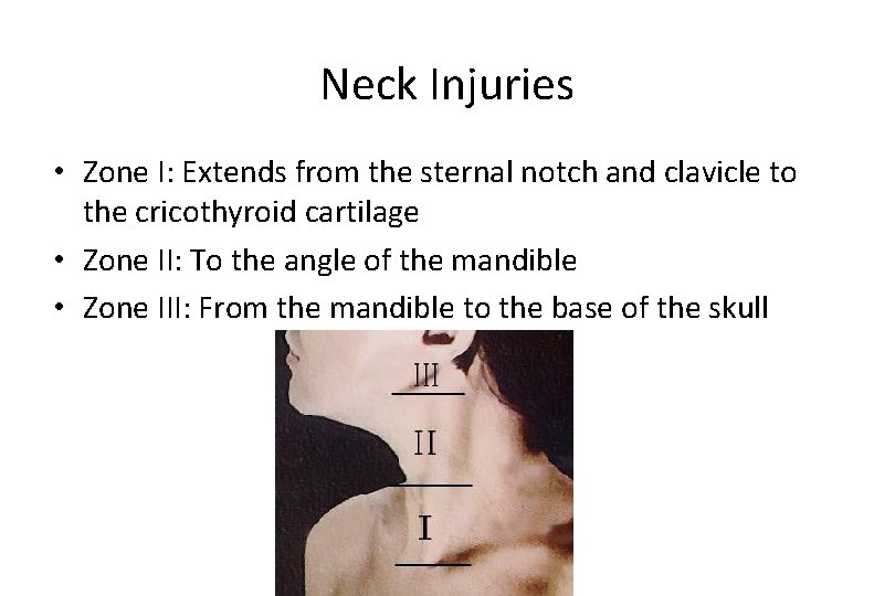Neck Injuries • Zone I: Extends from the sternal notch and clavicle to the