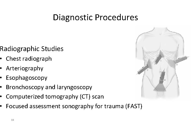 Diagnostic Procedures Radiographic Studies • • • Chest radiograph Arteriography Esophagoscopy Bronchoscopy and laryngoscopy