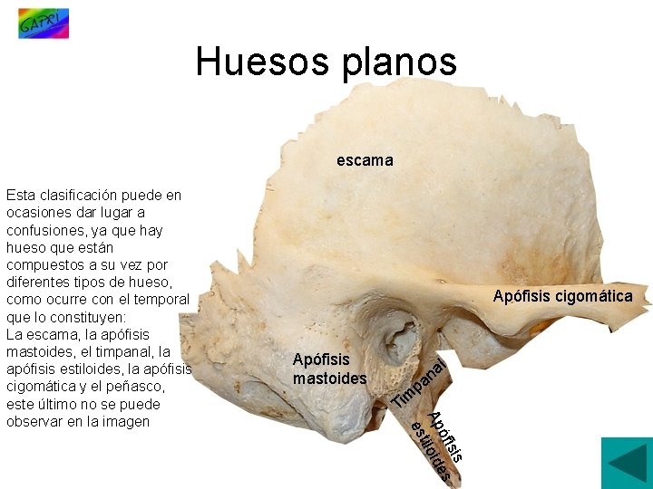 Huesos planos escama Apófisis cigomática Apófisis mastoides l a n pa m Ti sis