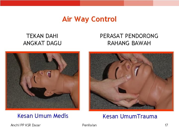 Air Way Control TEKAN DAHI ANGKAT DAGU PERASAT PENDORONG RAHANG BAWAH Kesan Umum Medis Air Way Control TEKAN DAHI ANGKAT DAGU PERASAT PENDORONG RAHANG BAWAH Kesan Umum Medis