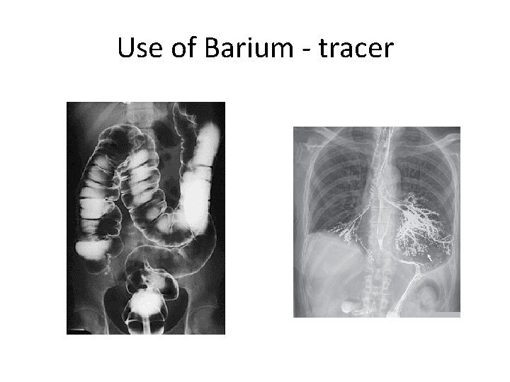 Use of Barium - tracer 