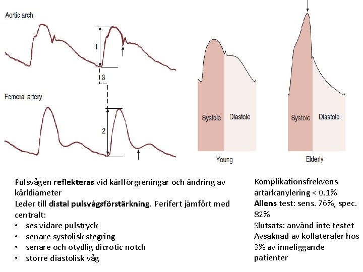 Pulsvågen reflekteras vid kärlförgreningar och ändring av kärldiameter Leder till distal pulsvågsförstärkning. Perifert jämfört Pulsvågen reflekteras vid kärlförgreningar och ändring av kärldiameter Leder till distal pulsvågsförstärkning. Perifert jämfört