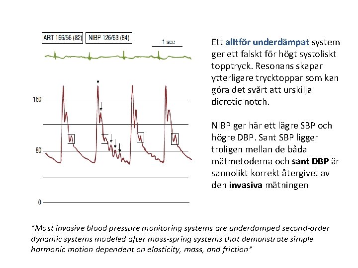 Ett alltför underdämpat system ger ett falskt för högt systoliskt topptryck. Resonans skapar ytterligare Ett alltför underdämpat system ger ett falskt för högt systoliskt topptryck. Resonans skapar ytterligare
