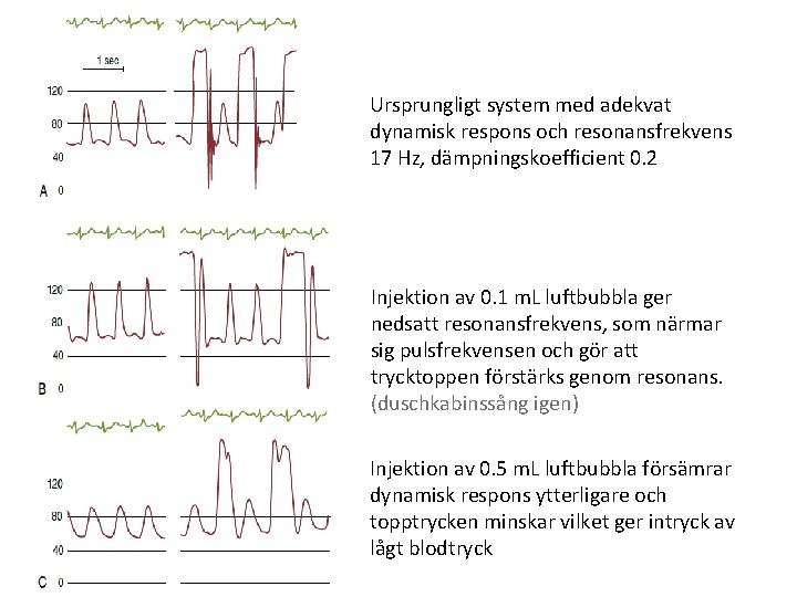 Ursprungligt system med adekvat dynamisk respons och resonansfrekvens 17 Hz, dämpningskoefficient 0. 2 Injektion Ursprungligt system med adekvat dynamisk respons och resonansfrekvens 17 Hz, dämpningskoefficient 0. 2 Injektion