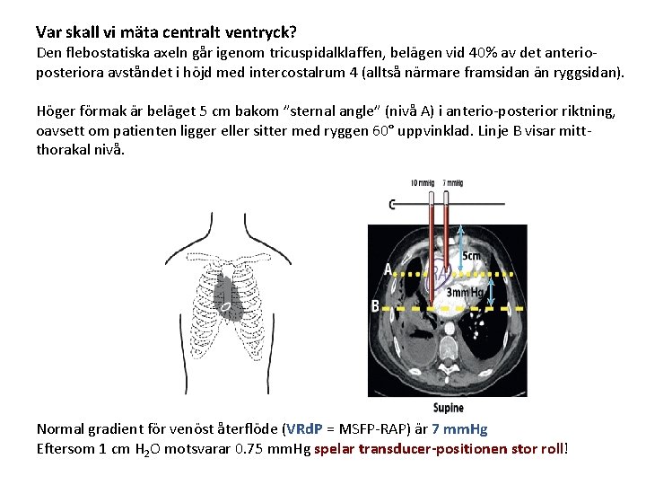 Var skall vi mäta centralt ventryck? Den flebostatiska axeln går igenom tricuspidalklaffen, belägen vid Var skall vi mäta centralt ventryck? Den flebostatiska axeln går igenom tricuspidalklaffen, belägen vid