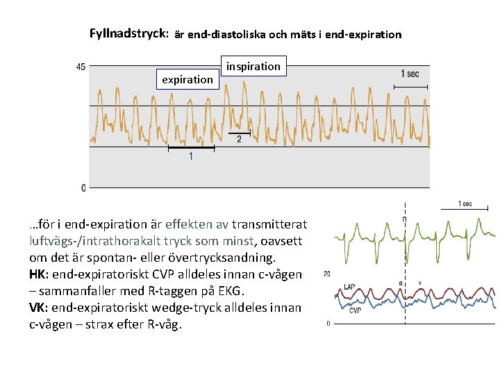 Fyllnadstryck: är end-diastoliska och mäts i end-expiration inspiration …för i end-expiration är effekten av Fyllnadstryck: är end-diastoliska och mäts i end-expiration inspiration …för i end-expiration är effekten av