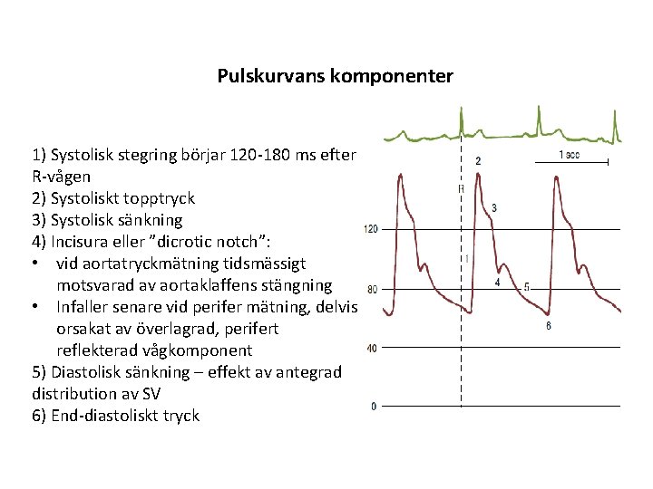 Pulskurvans komponenter 1) Systolisk stegring börjar 120 -180 ms efter R-vågen 2) Systoliskt topptryck Pulskurvans komponenter 1) Systolisk stegring börjar 120 -180 ms efter R-vågen 2) Systoliskt topptryck