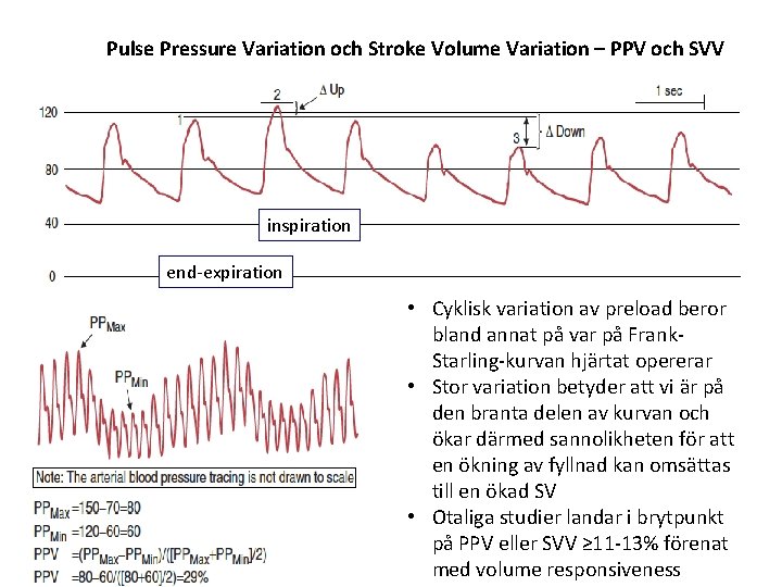 Pulse Pressure Variation och Stroke Volume Variation – PPV och SVV inspiration end-expiration • Pulse Pressure Variation och Stroke Volume Variation – PPV och SVV inspiration end-expiration •