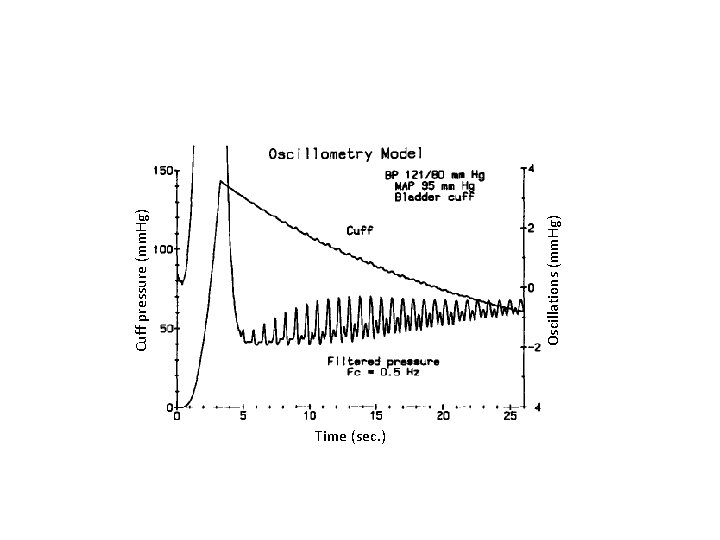 Time (sec. ) Oscillations (mm. Hg) Cuff pressure (mm. Hg) Time (sec. ) Oscillations (mm. Hg) Cuff pressure (mm. Hg)
